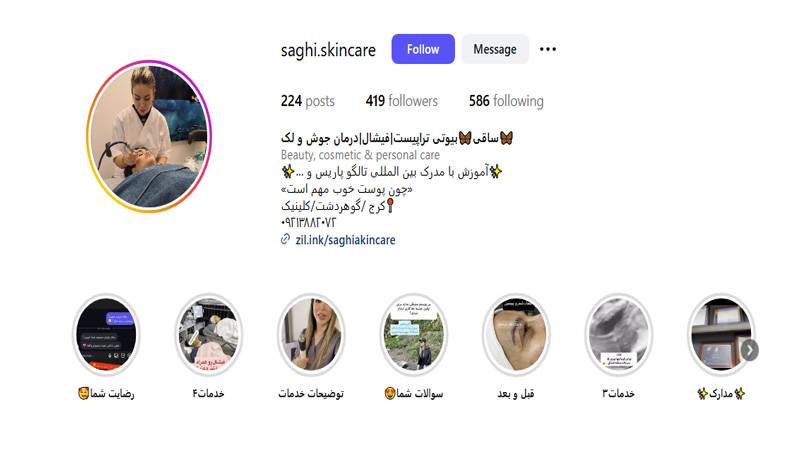 مرکز فیشیال ساقی بیوتی
