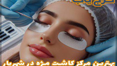 بهترین مرکز کاشت مژه در شهریار