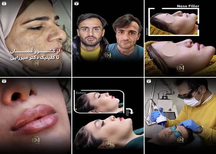 اینستاگرام مرکز لیزر دکتر بهزاد میرزایی