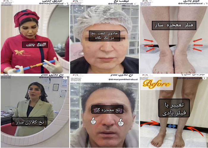 اینستاگرام مرکز لیزر دکتر مریم خیرآبادی