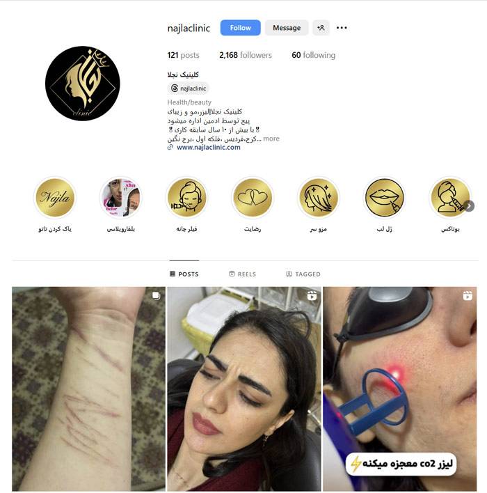اینستاگرام مرکز لیزر نجلا