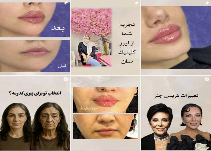 اینستاگرام مرکز لیزر سان
