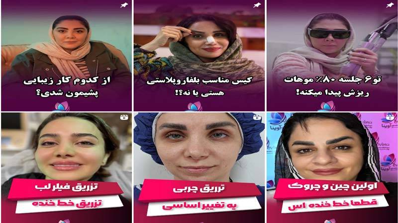 اینستاگرام مرکز لیزر آوینا