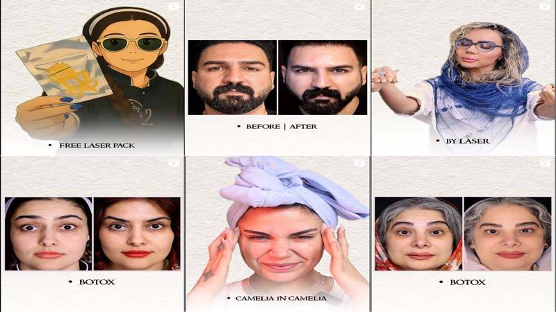 اینستاگرام مرکز لیزر کاملیا