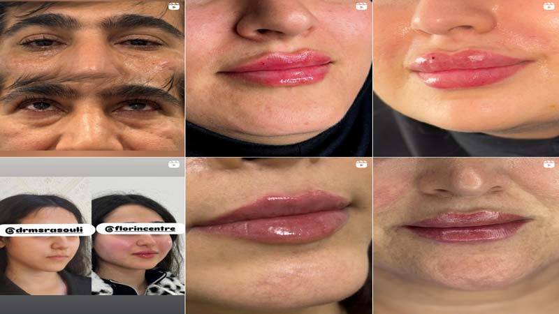 اینستاگرام کلینیک فلورین