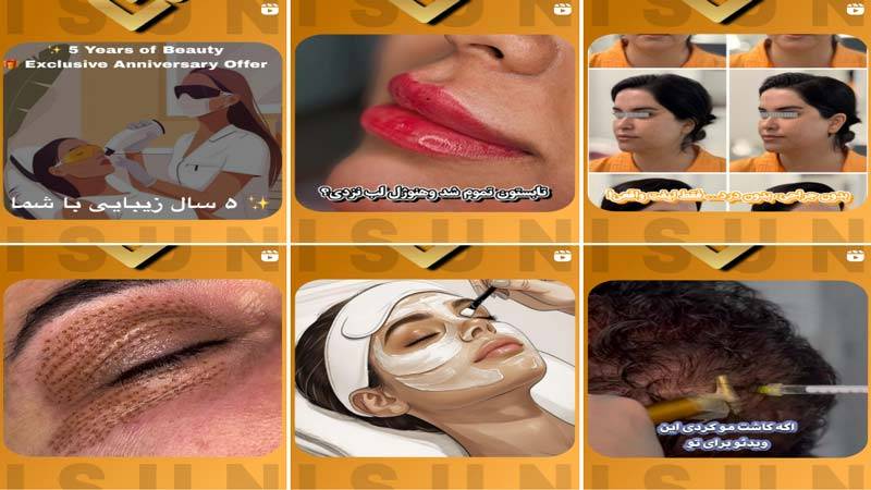 اینستاگرام مرکز لیزر آیسان