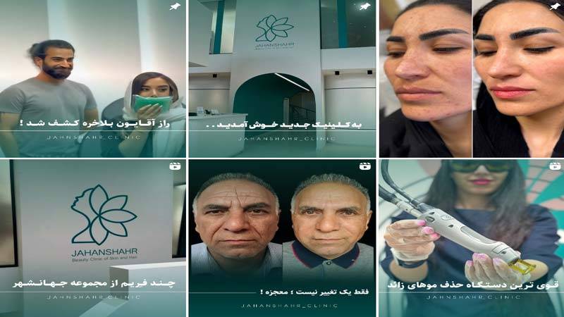 اینستاگرام مرکز لیزر جهانشهر