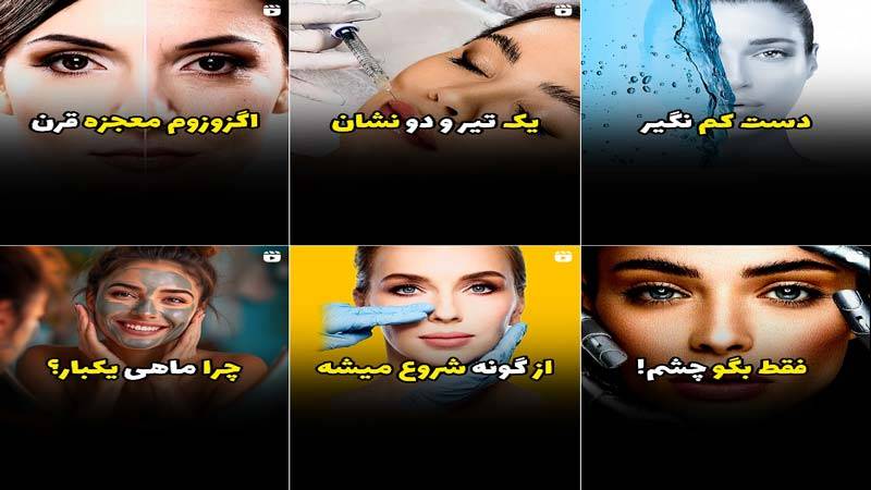 اینستاگرام مرکز لیزر لوتوس