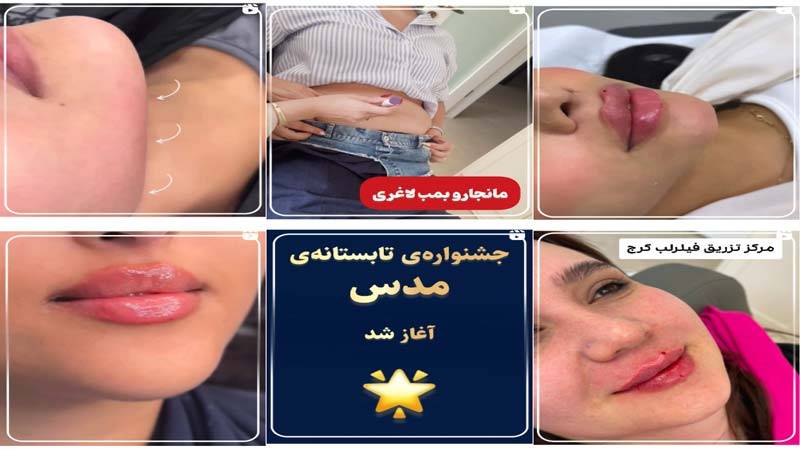 اینستاگرام کلینیک مدس