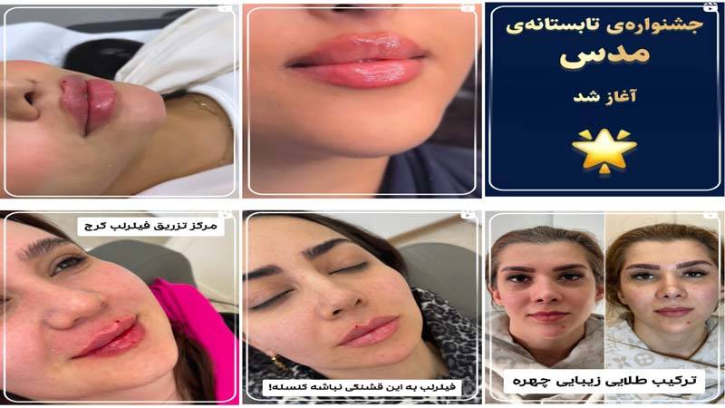 اینستاگرام مرکز لیزر مدس