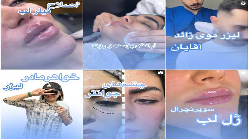 اینستاگرام مرکز لیزر مهرشهر