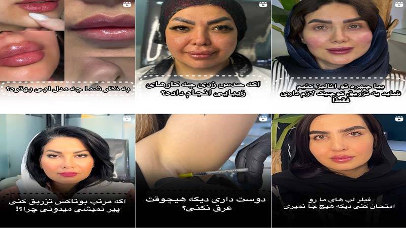 اینستاگرام کلینیک نگار