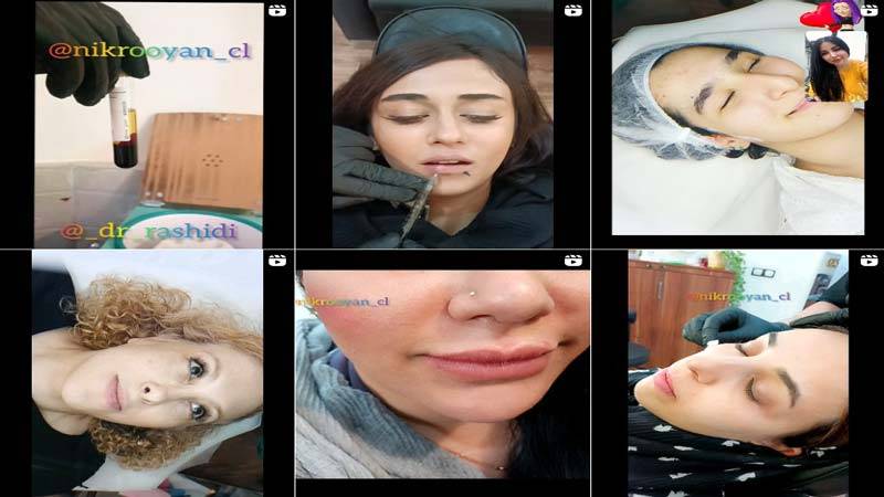 اینستاگرام مرکز لیزر نیک رویان