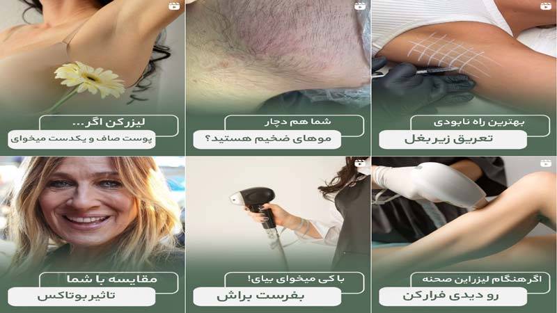 اینستاگرام مرکز لیزر پرتو