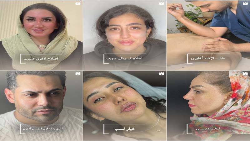 اینستاگرام مرکز لیزر رامیلا