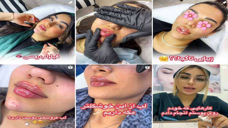 اینستاگرام مرکز لیزر رزا
