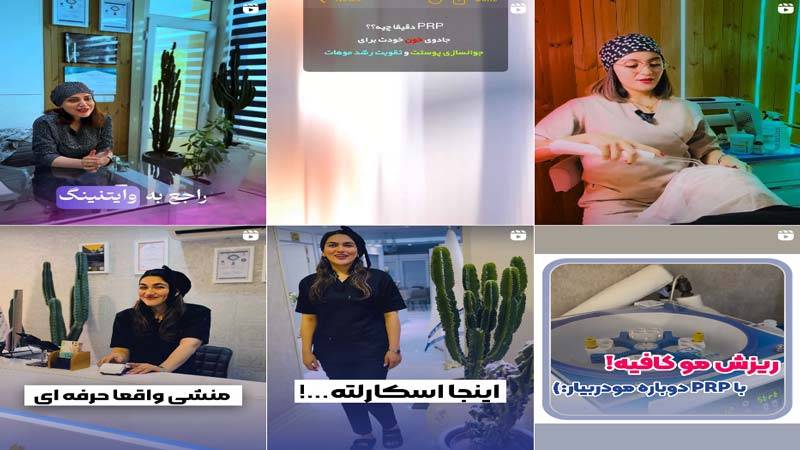 اینستاگرام مرکز لیزر اسکارلت