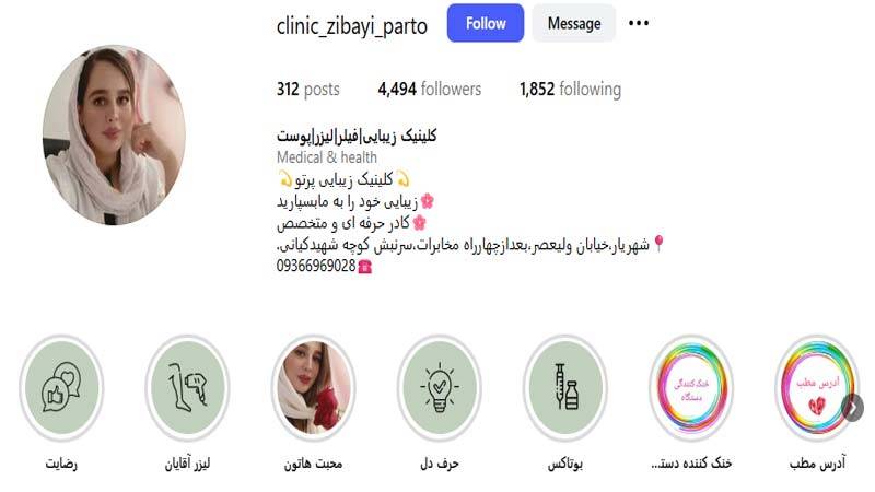 مرکز لیزر پرتو