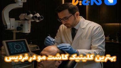 بهترین کلینیک کاشت مو در فردیس