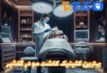 بهترین کلینیک کاشت مو در گلشهر