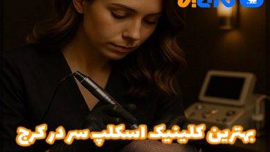 بهترین کلینیک اسکالپ سر در کرج