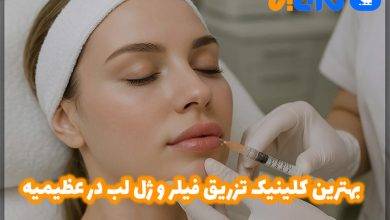 تزریق فیلر و ژل لب در عظیمیه