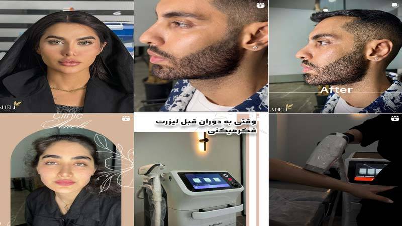 اینستاگرام کلینیک زیبایی آنلی