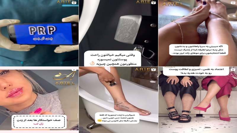 اینستاگرام کلینیک زیبایی آریل