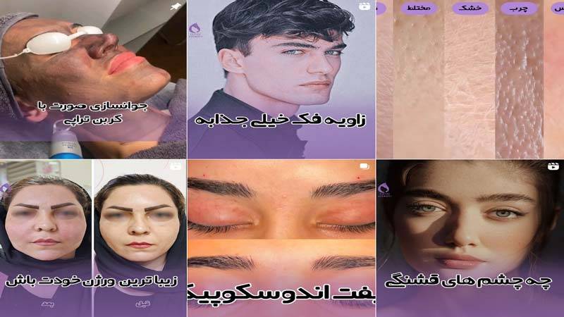 اینستاگرام کلینیک زیبایی عظیمیه