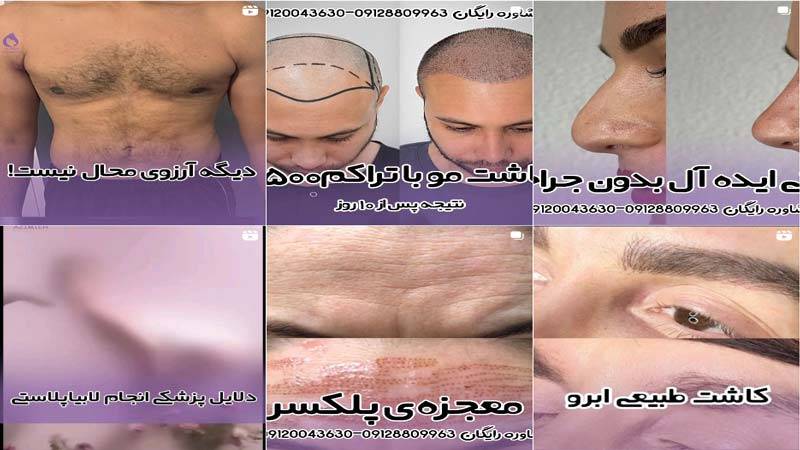 اینستاگرام کلینیک زیبایی عظیمیه