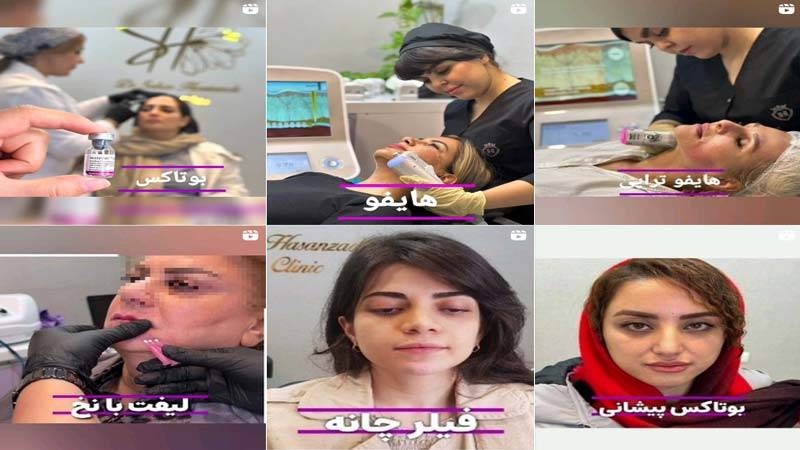 اینستاگرام کلینیک زیبایی دکتر حسن زاده