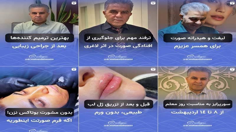 اینستاگرام کلینیک زیبایی دکتر محسنی