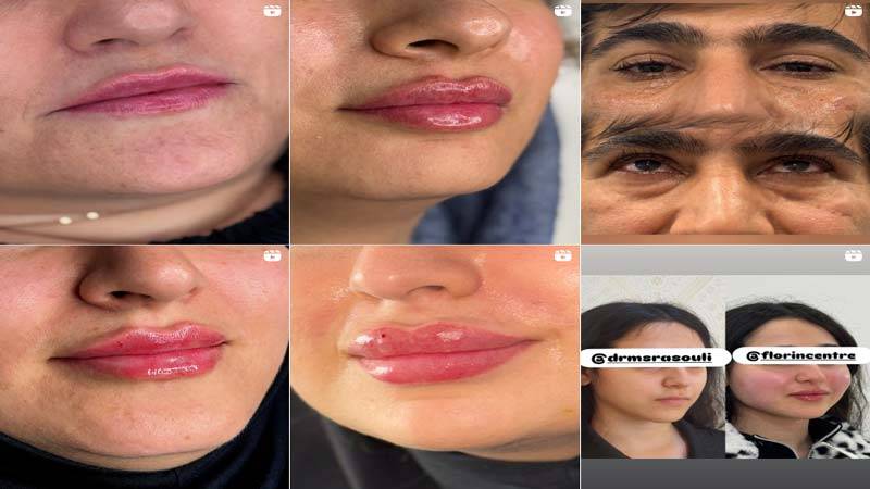 اینستاگرام کلینیک زیبایی فلورین