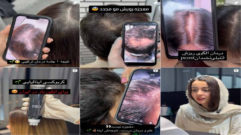 اینستاگرام کلینیک غزال