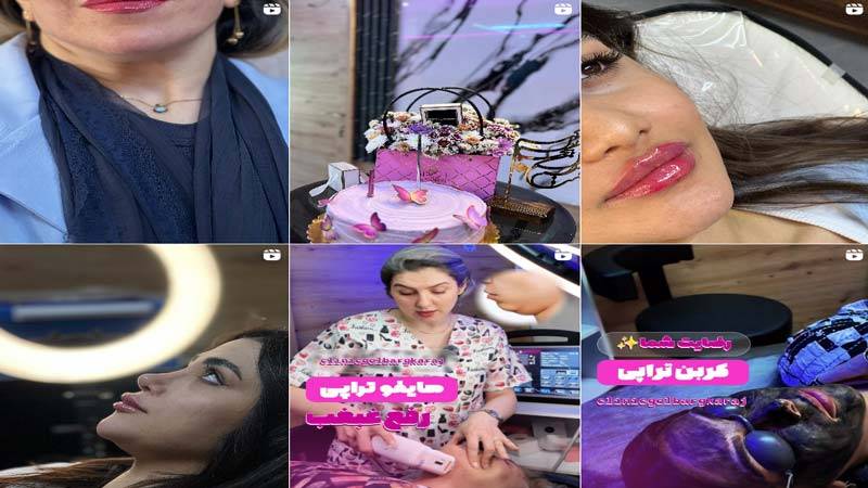 اینستاگرام کلینیک زیبایی گلبرگ