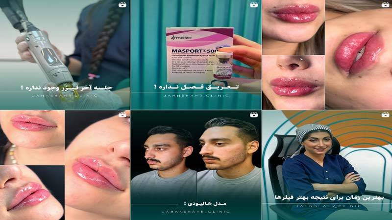 اینستاگرام کلینیک زیبایی جهانشهر