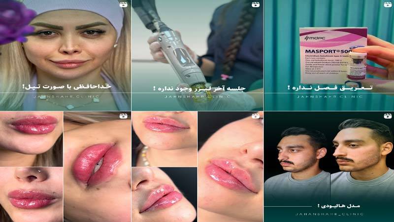 اینستاگرام کلینیک زیبایی جهانشهر