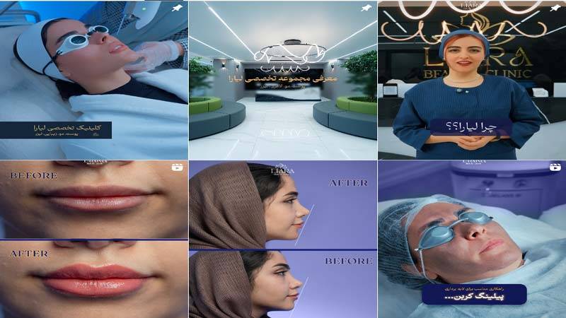 اینستاگرام کلینیک زیبایی لیارا