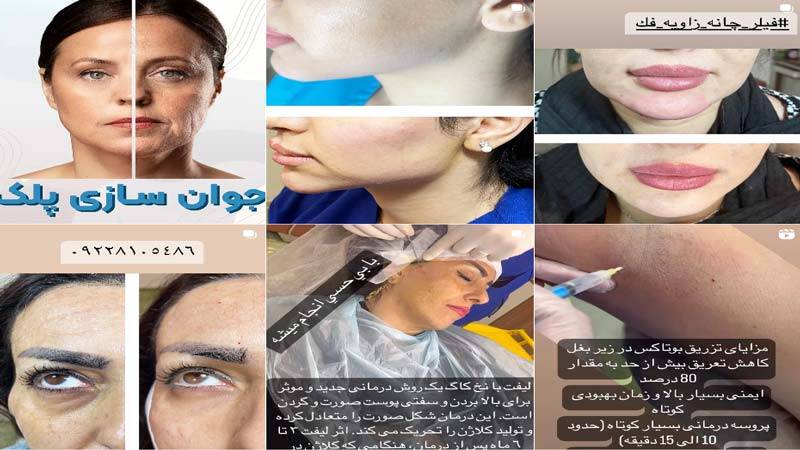 اینستاگرام کلینیک زیبایی ماد