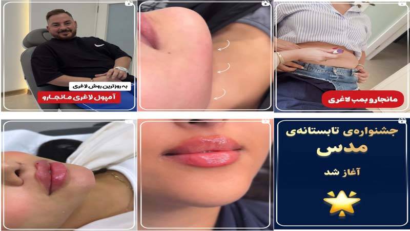 اینستاگرام کلینیک زیبایی مدس