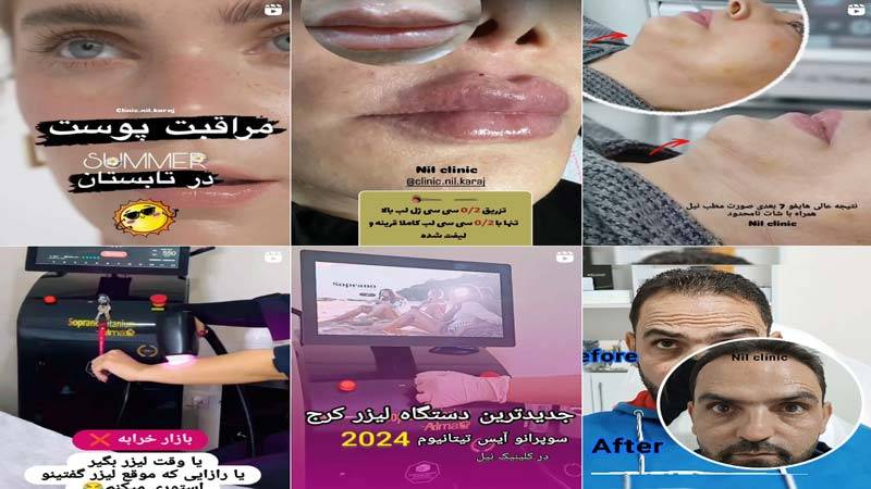 اینستاگرام کلینیک زیبایی نیل