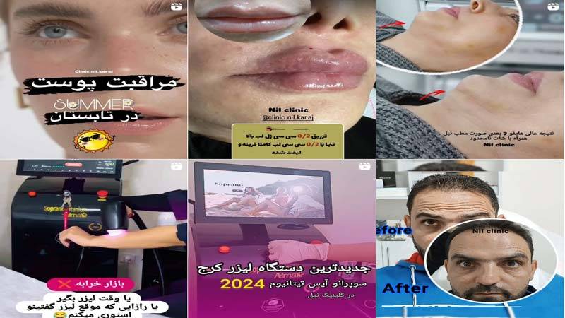 اینستاگرام کلینیک زیبایی نیل