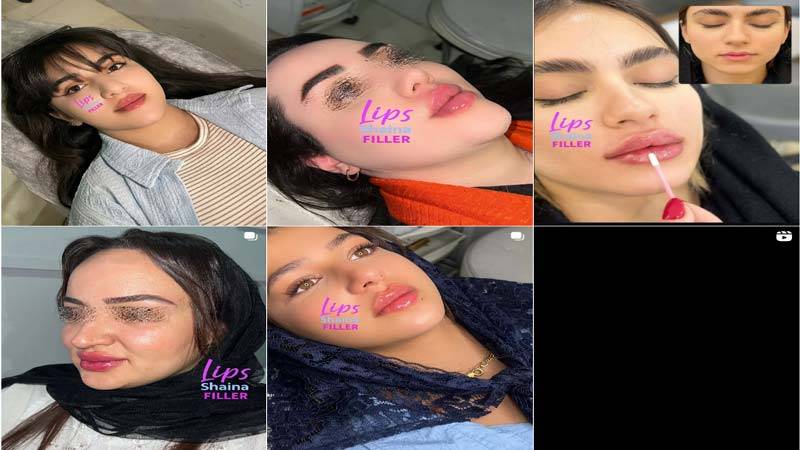 اینستاگرام کلینیک زیبایی صدر