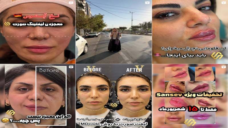 اینستاگرام کلینیک زیبایی سانسِو