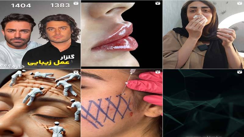 اینستاگرام کلینیک زیبایی سرو