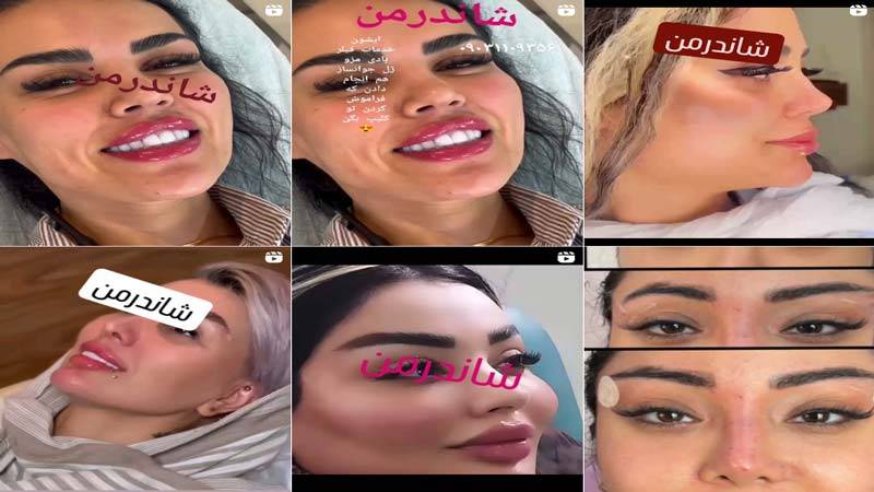 اینستاگرام کلینیک زیبایی شاندرمن