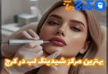 بهترین مرکز شیدینگ لب در کرج