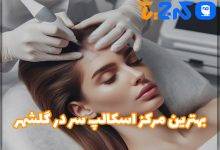 بهترین کلینیک اسکالپ سر در گلشهر