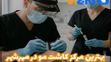 بهترین کلینیک کاشت مو در مهرشهر