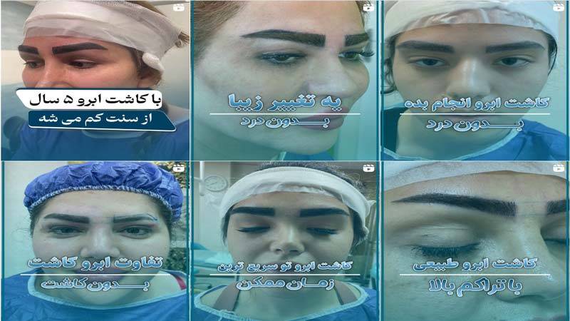 اینستاگرام کلینیک آریسا